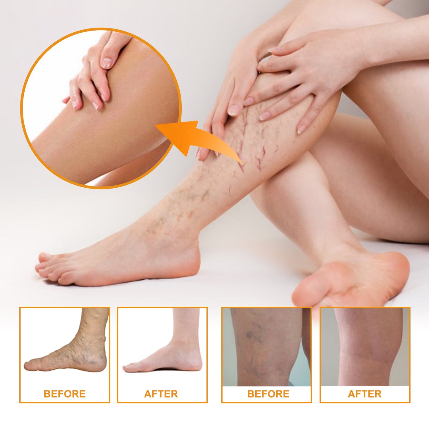 EELHOE Vitamin K Cream Skin Care For Sore And Swollen Legs Earthworm Leg Vein Massage Cream