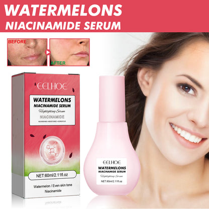 EELHOE Watermelons Niacinamide Serum, Dilute Spots Firming Haun White Skin Hydrating Moisture Essence