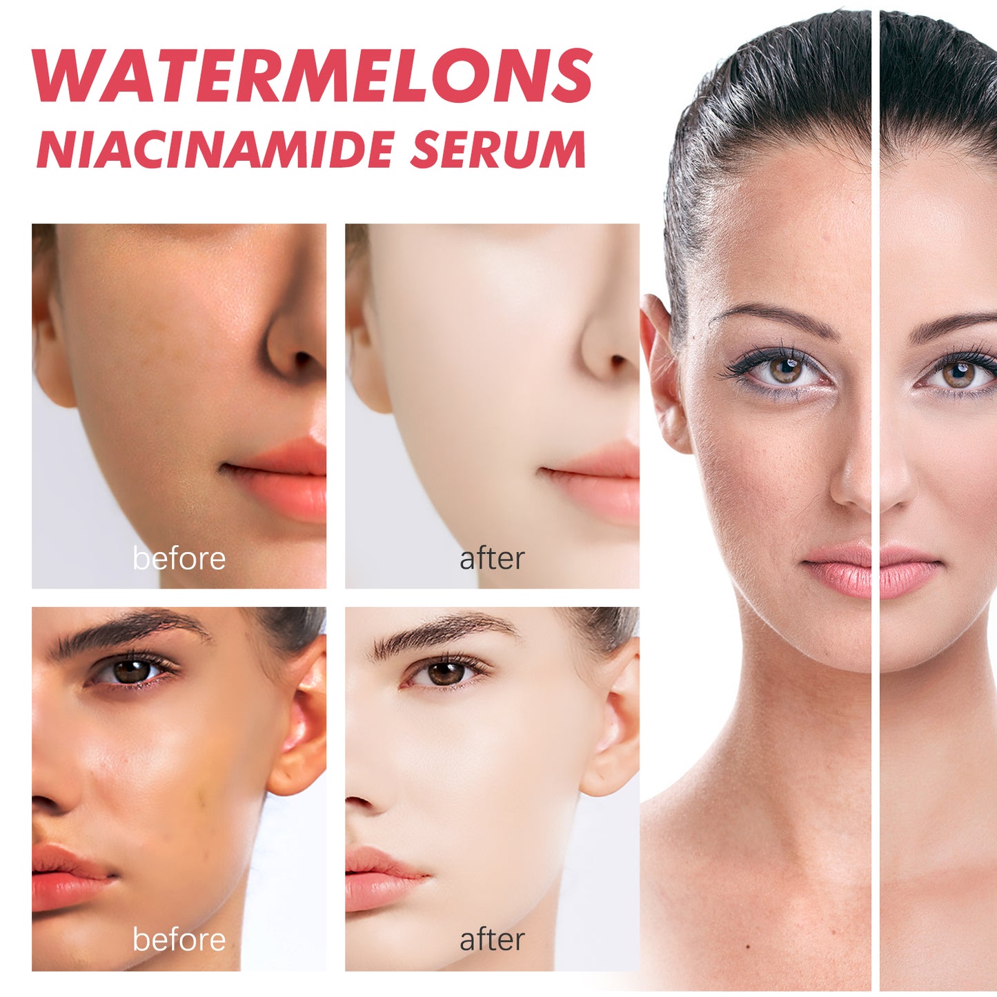 EELHOE Watermelons Niacinamide Serum, Dilute Spots Firming Haun White Skin Hydrating Moisture Essence