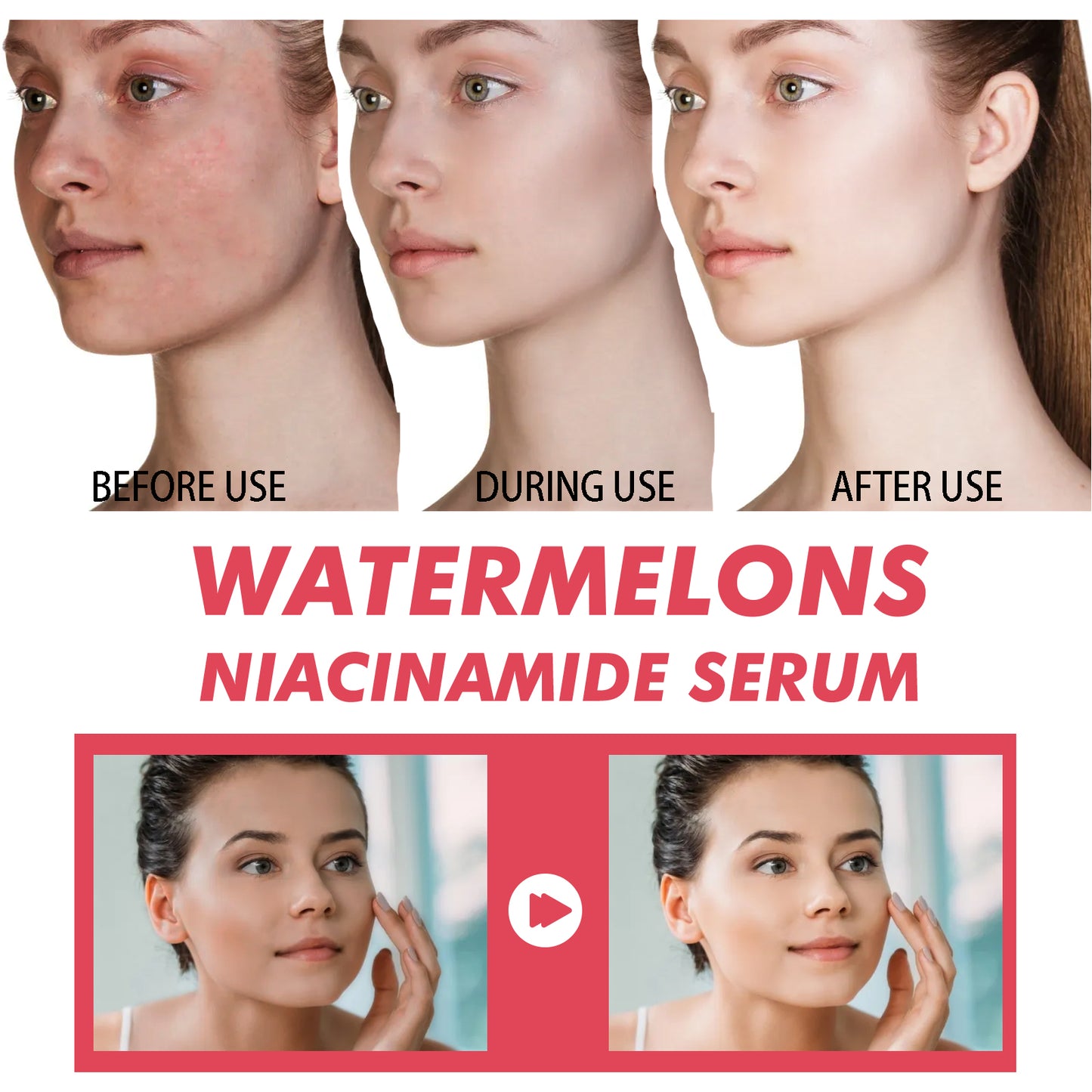 EELHOE Watermelons Niacinamide Serum, Dilute Spots Firming Haun White Skin Hydrating Moisture Essence