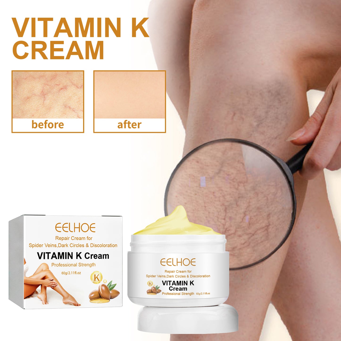 EELHOE Vitamin K Cream Skin Care For Sore And Swollen Legs Earthworm Leg Vein Massage Cream