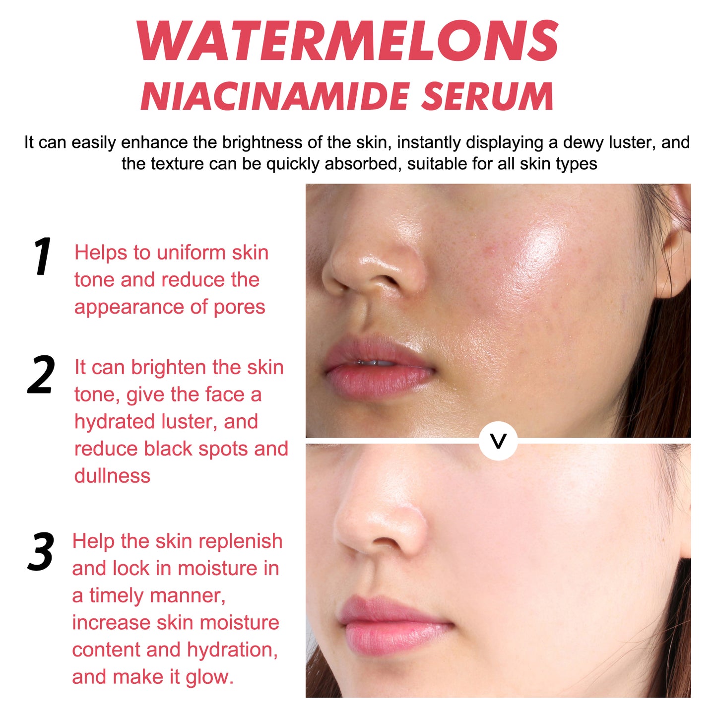 EELHOE Watermelons Niacinamide Serum, Dilute Spots Firming Haun White Skin Hydrating Moisture Essence