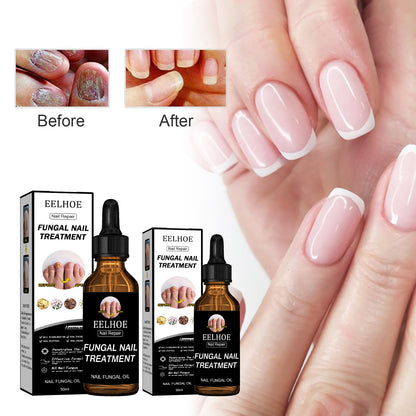 EELHOE Nail Repair Solution Thickening And Brightening Nails Removing Gray Nail Repair Nourishing Nail Care Solution